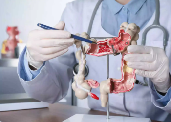 Nueva estrategia logra reducir las cirugías por cáncer de recto