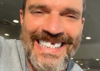 Julián Gil perdió un diente durante la grabación de un reality show