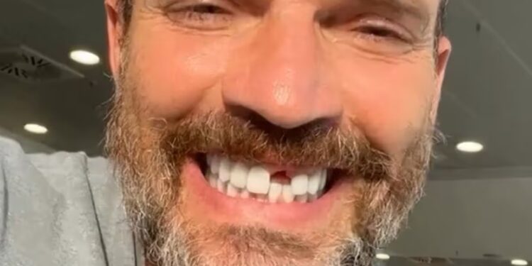 Julián Gil perdió un diente durante la grabación de un reality show