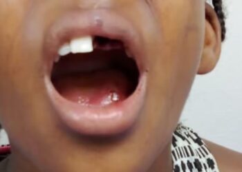 ¡A golpes! hombre le tumba dientes a su hija de 9 años