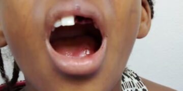 ¡A golpes! hombre le tumba dientes a su hija de 9 años