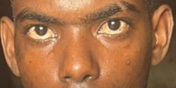 Apresan hombre por tener varias órdenes de arresto en 4 provincias