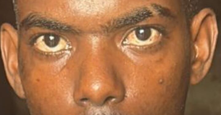 Apresan hombre por tener varias órdenes de arresto en 4 provincias