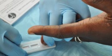 Semana Mundial del Tamizaje de VIH: Un llamado a la detección temprana 