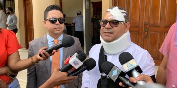 Regidor de Verón-Punta Cana denuncia brutal ataque por parte de empleados de Coco Bongo