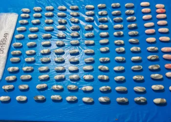 Atrapan nigeriano con 134 bolsitas de cocaína en el estómago