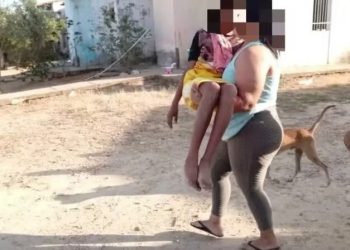 Niña de 12 años fue violada y quemada por su padrastro