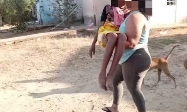 Niña de 12 años fue violada y quemada por su padrastro