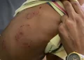 Denuncian niño sufre brutal agresión en CAIPI de Santiago