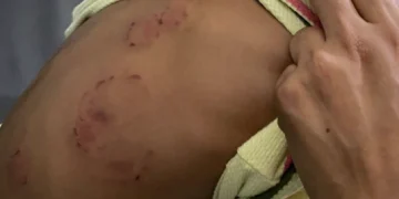 Denuncian niño sufre brutal agresión en CAIPI de Santiago