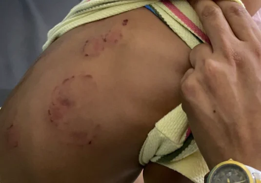 Denuncian niño sufre brutal agresión en CAIPI de Santiago