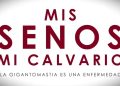 "Documental 'Mis Senos, Mi Calvario" impulsa la inclusión de cirugía de gigantomastia
