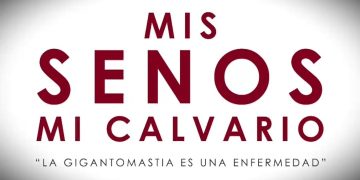 "Documental 'Mis Senos, Mi Calvario" impulsa la inclusión de cirugía de gigantomastia 