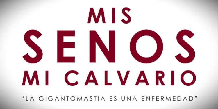 "Documental 'Mis Senos, Mi Calvario" impulsa la inclusión de cirugía de gigantomastia 