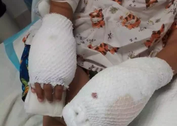 Una mujer es acusada de causar quemaduras a su hijo en La Vega