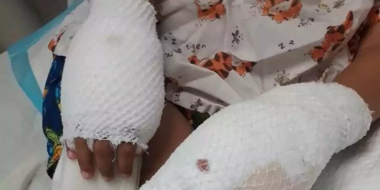 Una mujer es acusada de causar quemaduras a su hijo en La Vega