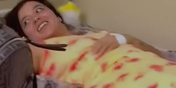 Colombiana estable tras resultar herida en colapso del Jet Set