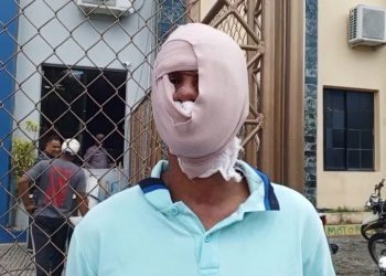 Por 200 pesos queman rostro a hombre con sancocho hirviendo en Santiago