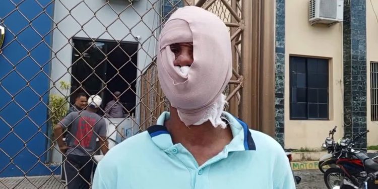 Por 200 pesos queman rostro a hombre con sancocho hirviendo en Santiago