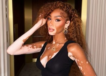 Día Mundial del Vitiligo: más allá de la piel, una causa global por la inclusión