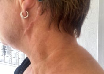 Mujer denuncia su hermano intentó matarla por una herencia