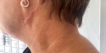 Mujer denuncia su hermano intentó matarla por una herencia