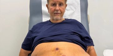 Raúl de Molina detalla las complicaciones que sufrió tras una cirugía: “Estaba botando sangre por todos lados”