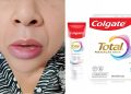 Autoridades reiteran alerta sanitaria sobre pasta dental Colgate Total Clean Mint