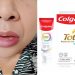 Autoridades reiteran alerta sanitaria sobre pasta dental Colgate Total Clean Mint