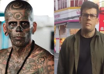 Luce irreconocible tras cirugía para quitarse todos sus tatuajes