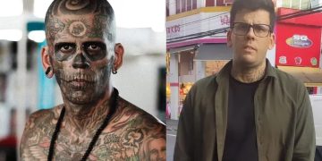 Luce irreconocible tras cirugía para quitarse todos sus tatuajes