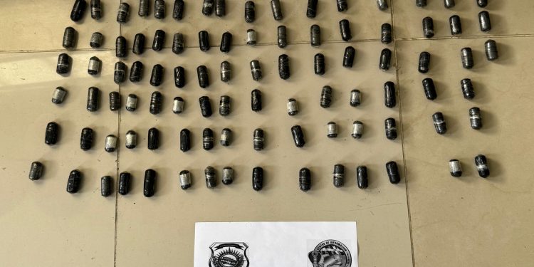 Atrapan en el AILA francés con estómago lleno de bolsitas de cocaína