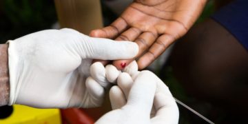 RD tiene más de 85 mil personas viviendo con VIH; COIN realizará pruebas gratuitas del 17 al 23 de noviembre