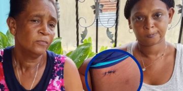 Mujer denuncia fue brutalmente atacada por peligrosa banda mantiene en zozobra a barrios de San Luis