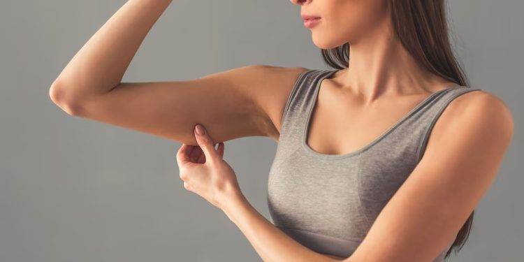 Cómo eliminar el famoso “salero”, la grasa ubicada en la parte posterior del brazo