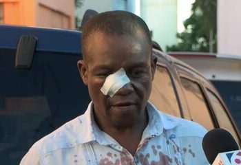 ADP otorga acompañamiento legal al profesor agredido en liceo Juan Pablo Duarte