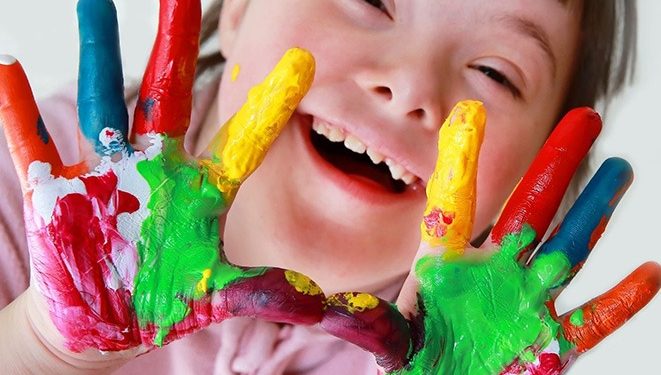 21 de marzo: Día Mundial del Síndrome de Down