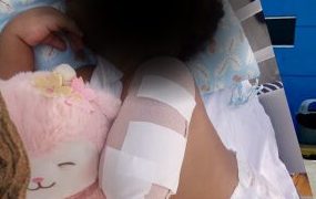 Hospital de Engombe guarda silencio ante caso de niña que perdió un brazo