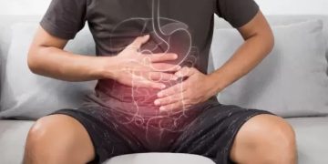 Cáncer de colon: detectarlo a tiempo salva hasta el 90 % de los pacientes