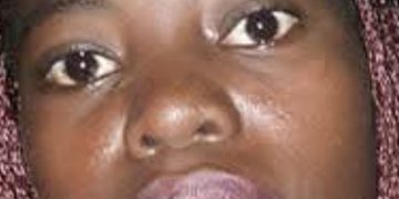 Haitiana quema las manos de su hijo menor de edad por mil pesos