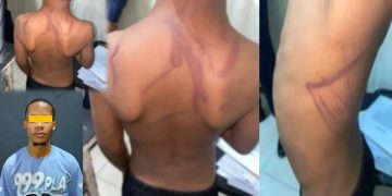 Apresan hombre tras propinar golpiza con un cable a su hijo y amenazar a la madre