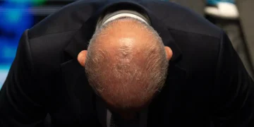 Lula inicia un tratamiento de radioterapia en el cuero cabelludo