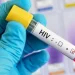 Salud Pública garantiza continuidad de tratamientos para personas con VIH y reafirma que actualizaciones terapéuticas responden a evidencia científica