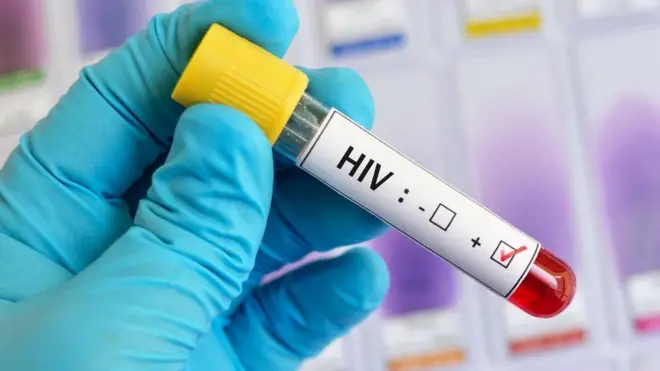 Salud Pública garantiza continuidad de tratamientos para personas con VIH y reafirma que actualizaciones terapéuticas responden a evidencia científica