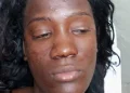Mujer resulta herida tras violento ataque con botella durante riña