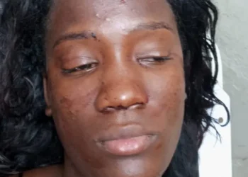 Mujer resulta herida tras violento ataque con botella durante riña