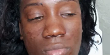 Mujer resulta herida tras violento ataque con botella durante riña