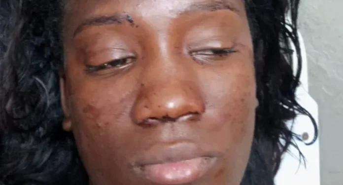 Mujer resulta herida tras violento ataque con botella durante riña