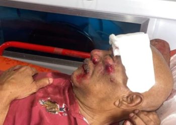 Familiares piden identificar a motorista que dejó gravemente herido a ingeniero en la San Vicente de Paúl