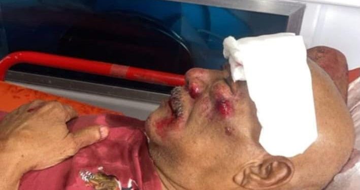 Familiares piden identificar a motorista que dejó gravemente herido a ingeniero en la San Vicente de Paúl